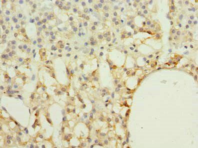 RAB33A antibody