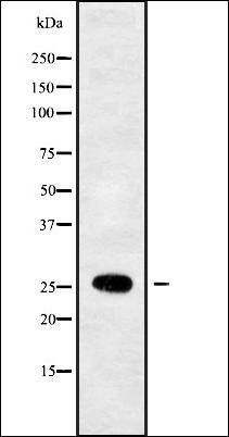RAB33B antibody