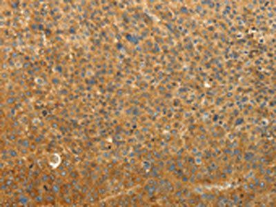 RAB35 Antibody