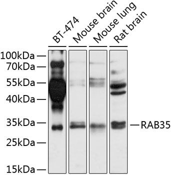 RAB35 antibody