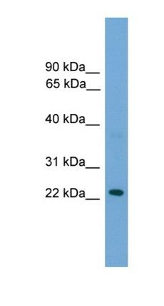RAB39A antibody