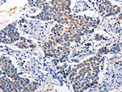 RAB39A Antibody