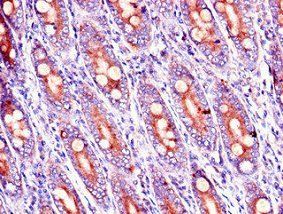 RAB39B Antibody