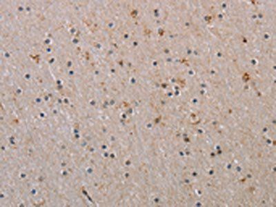 RAB39B Antibody