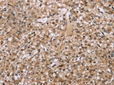 RAB39B Antibody