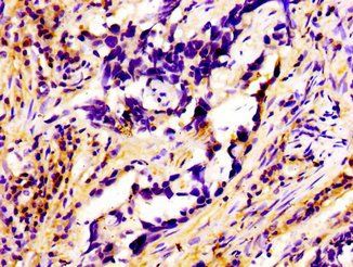 RAB3A Antibody