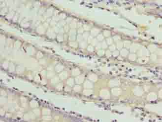 RAB3B Antibody