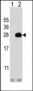 RAB3B antibody