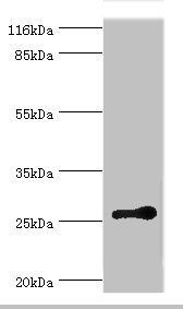 RAB3C Antibody