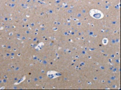 RAB3C Antibody