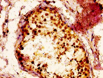 RAB3GAP1 Antibody
