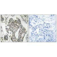 RAB3GAP2 Antibody