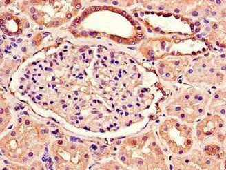 RAB3IP Antibody