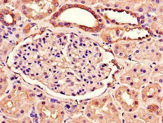 RAB3IP antibody