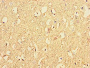 RAB40B Antibody