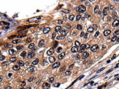 RAB41 Antibody