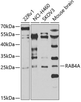 RAB4A antibody