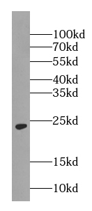 RAB5A-Specific antibody