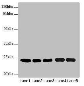 RAB5B antibody