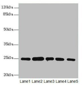 RAB5B antibody