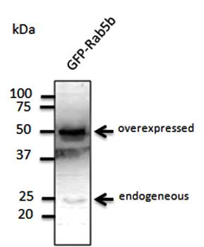 Anti-Rab5b