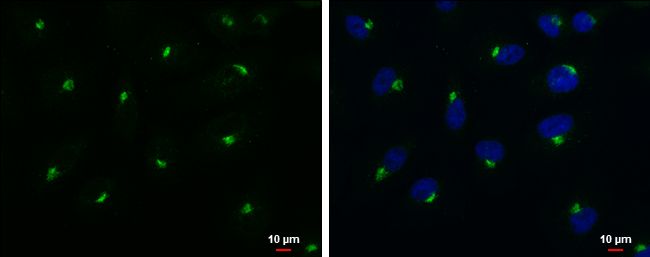 RAB6A, member RAS oncogene family Antibody