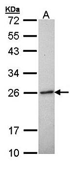 RAB6A antibody