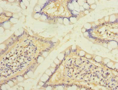 RAB6B Antibody