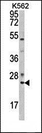 RAB7 antibody