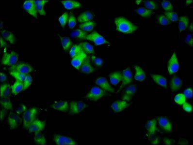 RAB7B Antibody