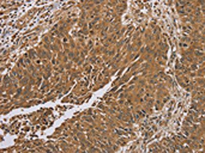 RAB8A Antibody