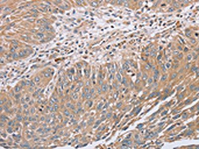 RAB8B Antibody