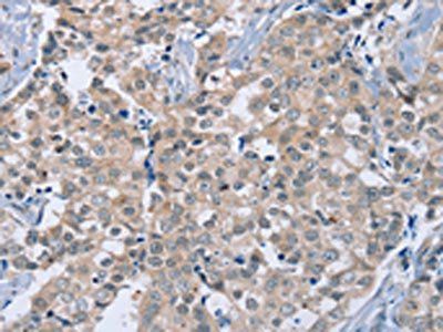 RAB8B Antibody