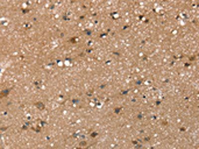 RAB9A Antibody