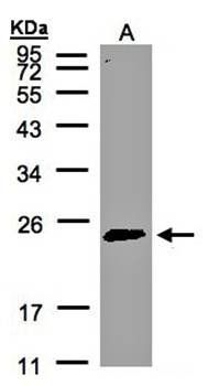 Rab 2 antibody