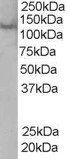 Goat anti-Rabenosyn 5 Antibody