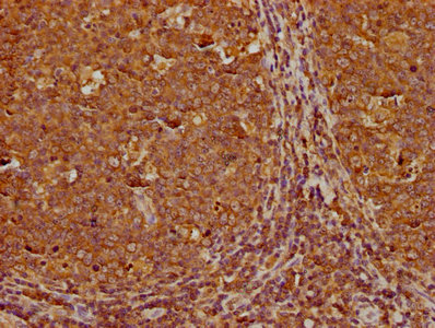 RABEP1 antibody