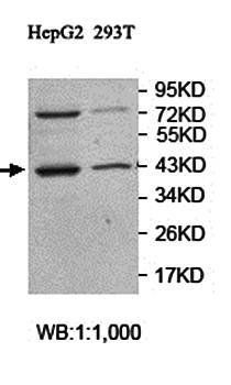 RABEPK Rabbit Polyclonal Antibody