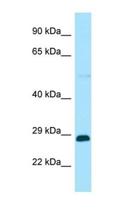 RABGAP1L antibody