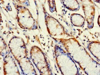 RABGAP1L Antibody