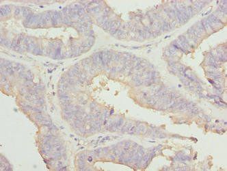 RABGEF1 Antibody