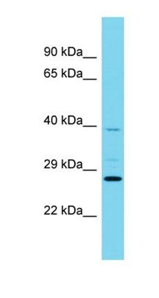 RABL6 antibody