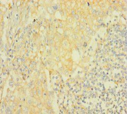 AKT2 Antibody