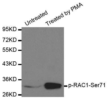 RAC1 (phospho-S71) antibody