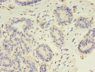 RAD17 Antibody