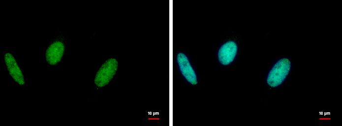 RAD18 Rabbit Polyclonal Antibody
