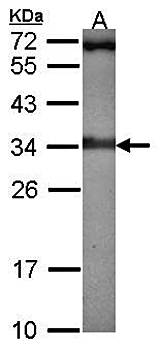 Rad1 antibody