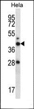 RAD23A antibody