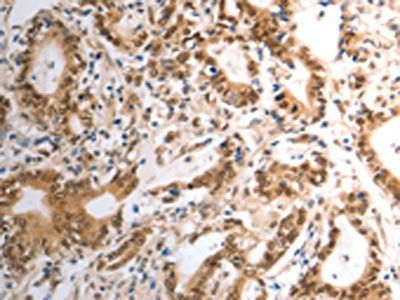 RAD50 Antibody