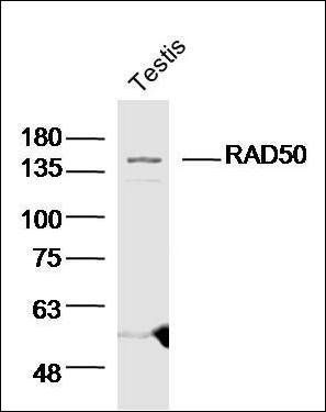 RAD50 antibody